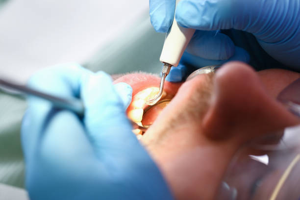 Best Cracked Tooth Emergency Dentist  in Sussex, NJ